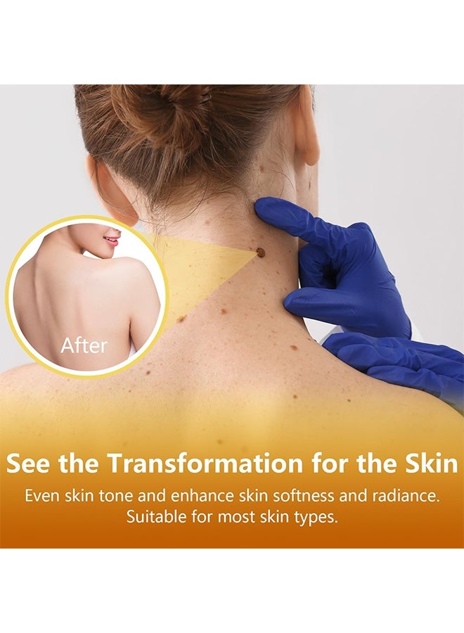 ximonth Microneedle Botanic Skin Tag Solution Patch, 9 Pcs Skin Tag Remover Patches,  Acne Blemish Remover, Balances Oil And Moisture, Safe & Gentle, Waterproof Adhesive, Natural Plant, Based Ingredients For Small To Medium Skin Tags On Face & Body - Image 4